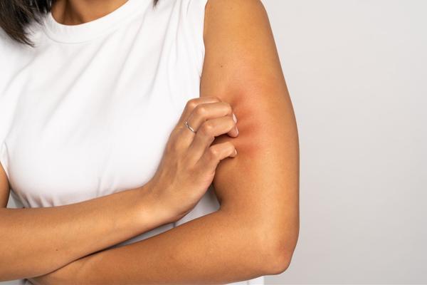 A woman wearing a white tank top and a skinny sliver ring on her right middle finger, is scratching her left bicep with her right hand.